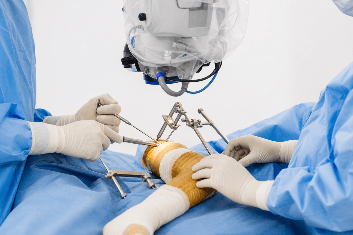 Gait Correction Surgeries