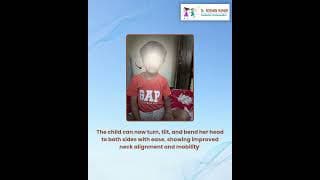 Torticollis, also known as “wry neck,” is a condition in children where the neck muscles…