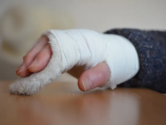 Fractures Treatment