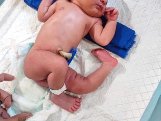 Syndromic Cases Treatment